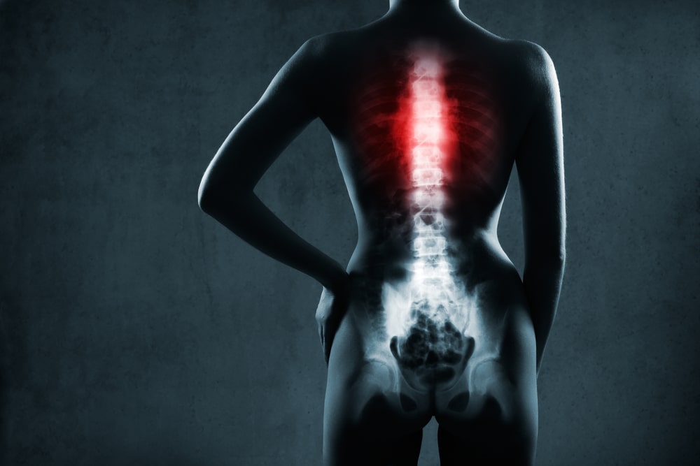 Spinal Injury Lawyer